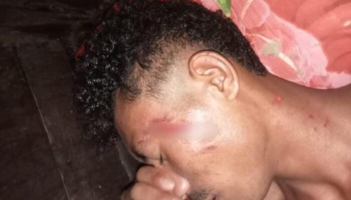 ‎Pengeroyokan Pemain di Laga Turnamen Amal St. Yosep, Suporter dan Kepala Desa Diduga Terlibat